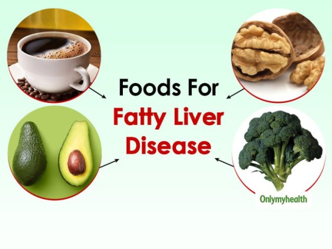 Liver fatty diet detox snacks What is good diet for fatty liver