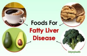 What Diet for Fatty Liver: A Guide to Healthy Eating What diet for fatty liver